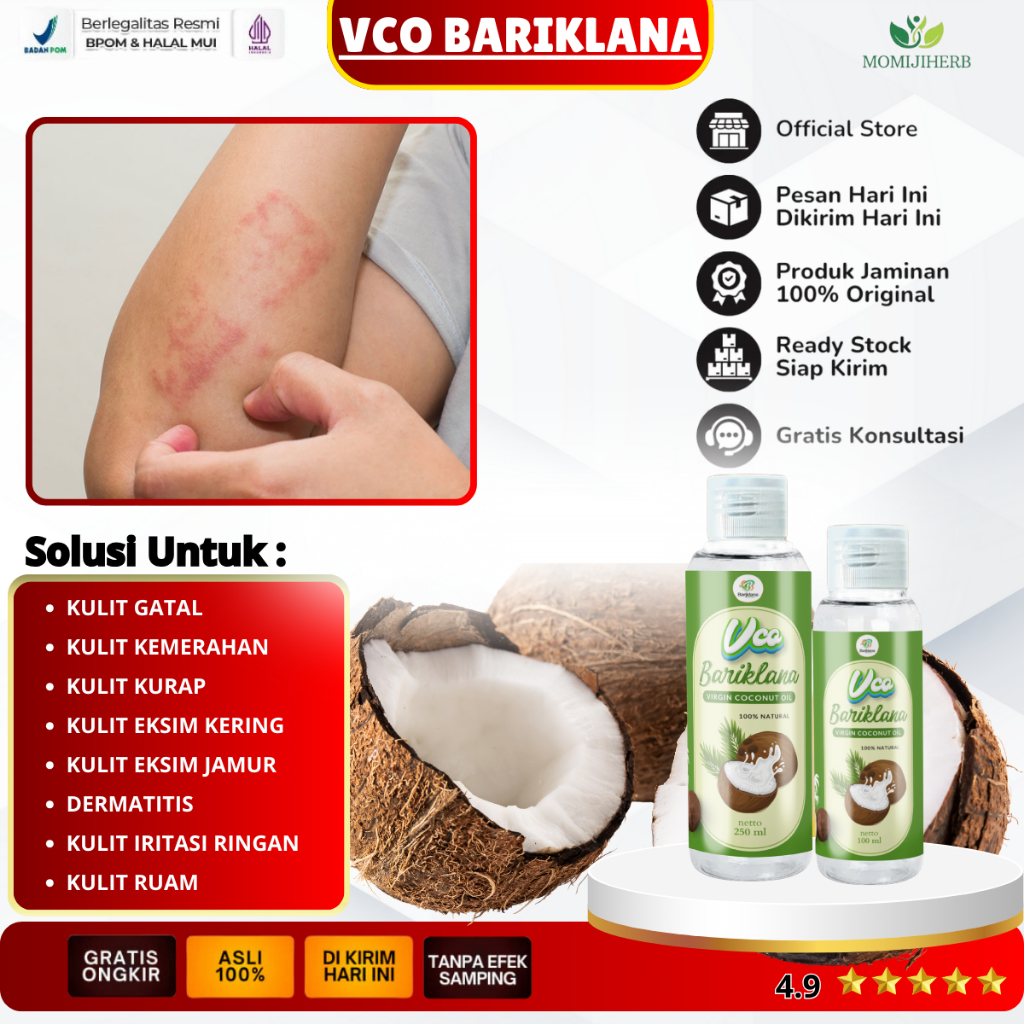 VCO BARIKLANA OBAT ALERGI KULIT, OBAT GATAL SELANGKANGAN, DERMATITS, OBAT EKSIM JAMUR, OBAT EKSIM KE