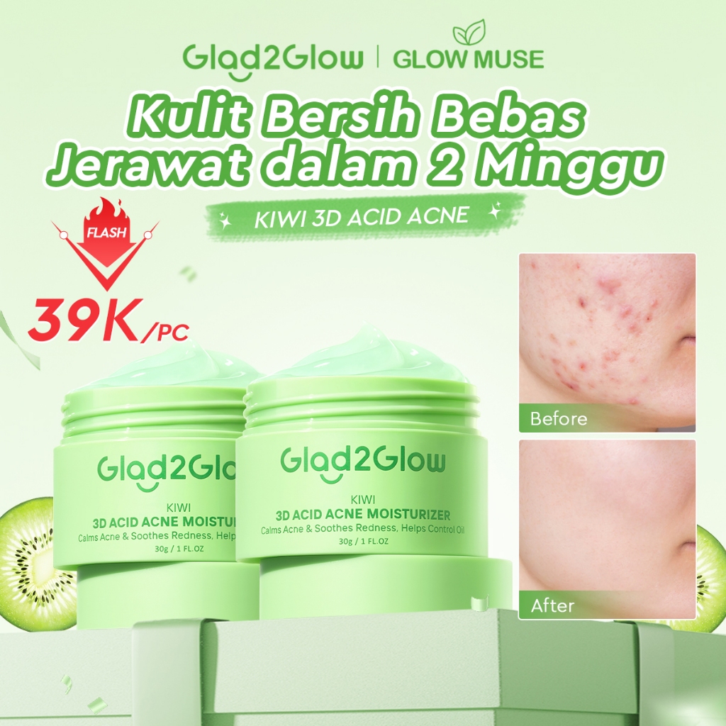 [100% ORI]GLAD2GLOW KIWI 3D ACID ACNE MOISTURIZER   Pelembab Wajah  Jerawat Day & Night Cream  Skinc