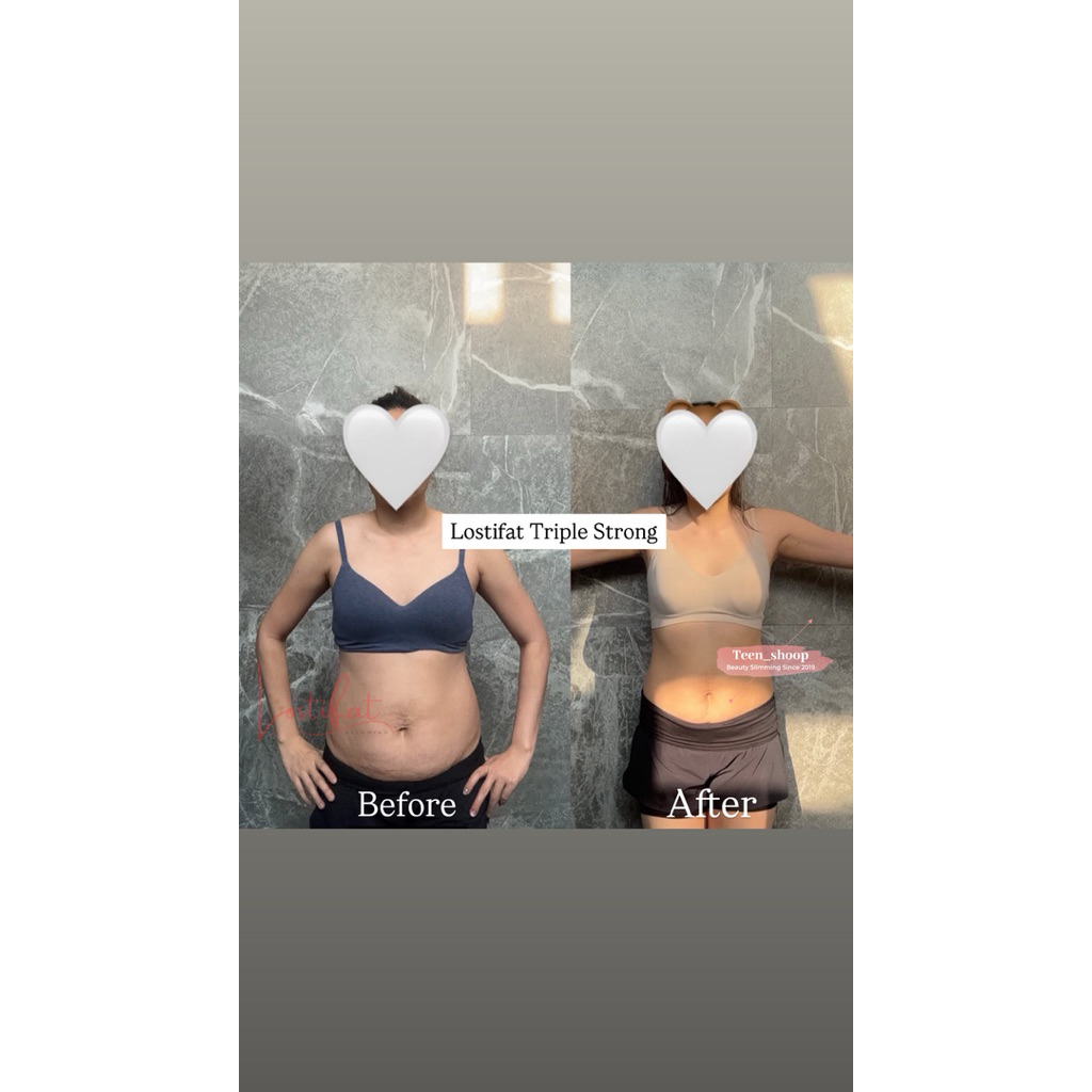 Lostifat Perbox Triple Strong