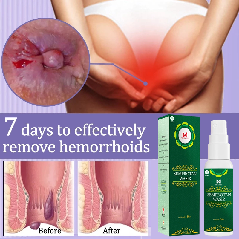 salep ambeien paling ampuh salep wasir salep wasir ampuh asli china aman dan tidak sakit Penyembuhan