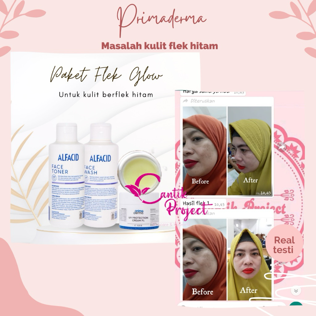 PRIMADERMA PAKET FLEK GLOW  / FLEK PARAH