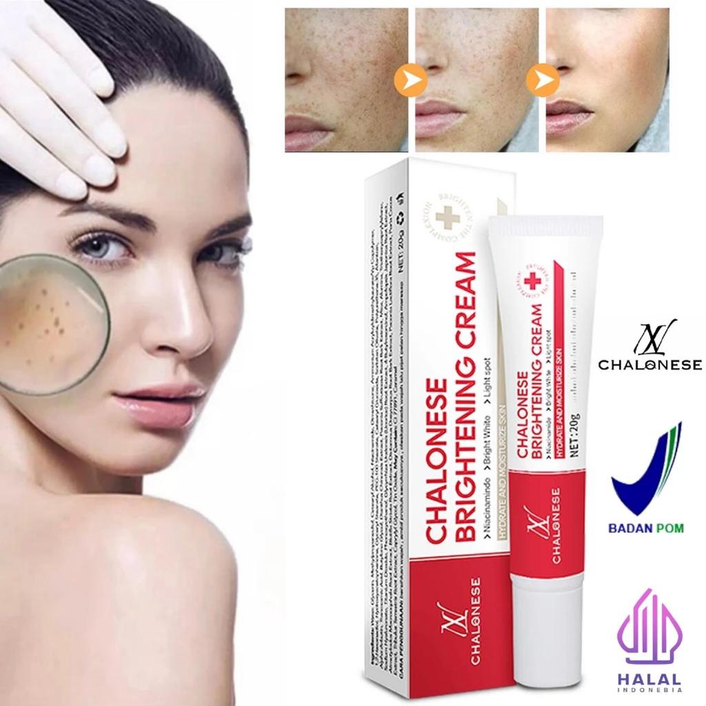 CHALONESE Freackle & Healthy Glowing Cream CHALONESE CREAM WHITENING BPOM 20gr ns