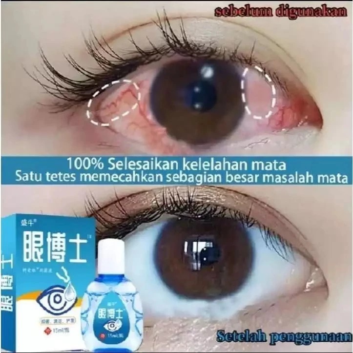 Obat Tetes Mata Ampuh Mengobati Pterigium Glukoma Mata Silinder dan Katarak BEST QUALITY