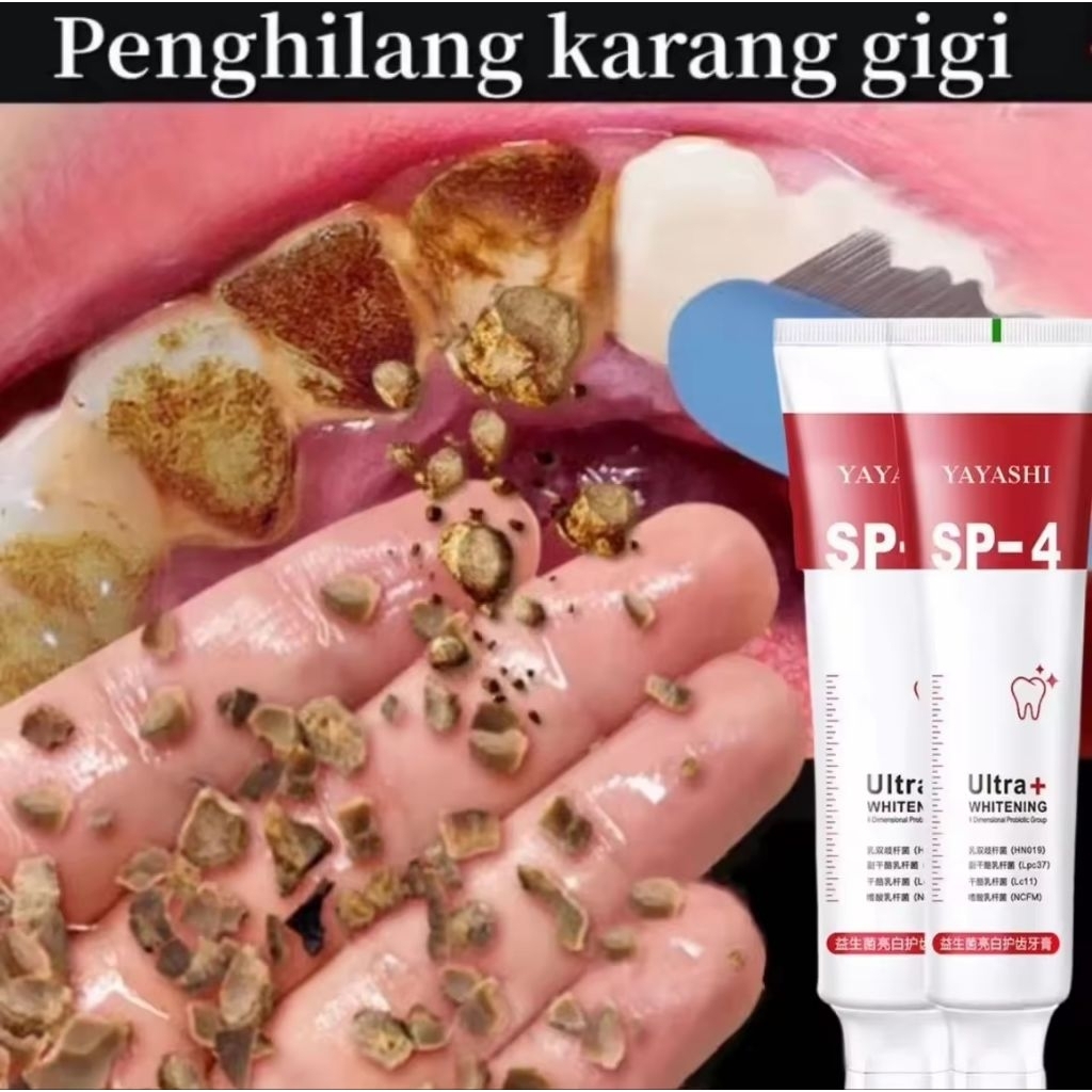 Pasta Gigi Probiotik SP-4 (Whitening/Gigi Putih), Pasta Gigi Pemutih/Odol Pemutih Gigi dan Karang Gi