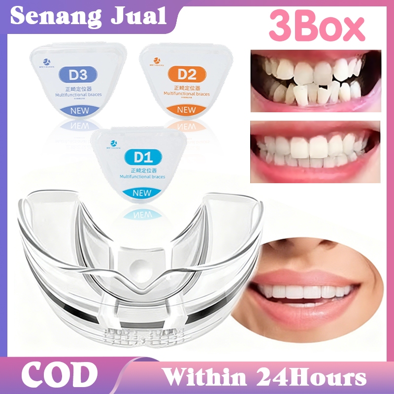 3Pcs/Set Behel Gigi Transparan Tak Terlihat / Behel Kawat Gigi Transparan / Allignment Orthodentic R