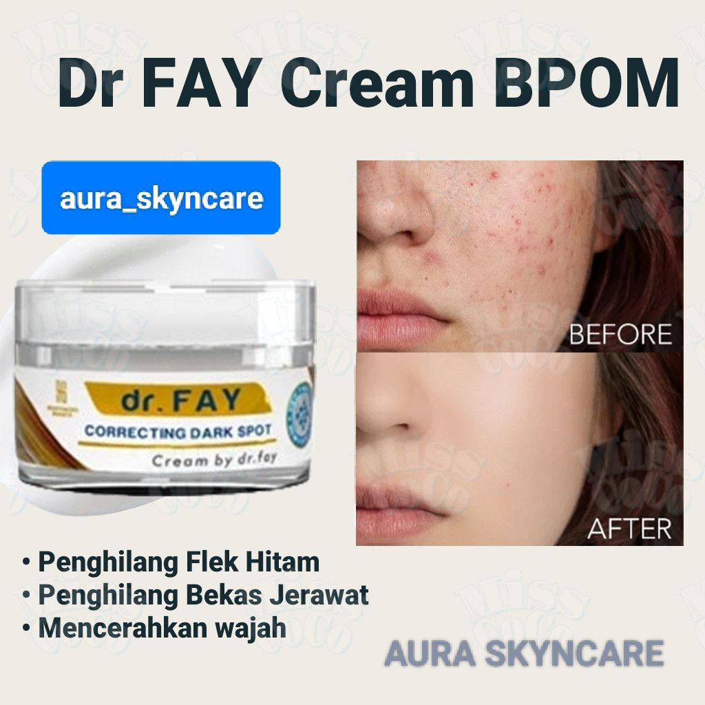 DR FAY CREAM PENGHILANG BOPENG BEKAS JERAWAT ( DR FAY )