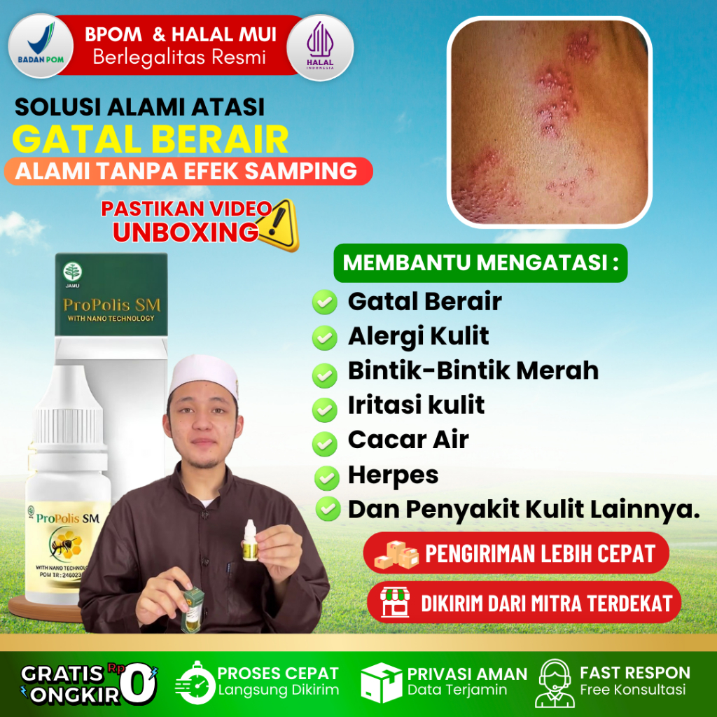 Obat Tetes Gatal Berair di Jari Tangan dan Kaki - Obat Bintik Bening, Berair, Gatal, Bernanah - Obat