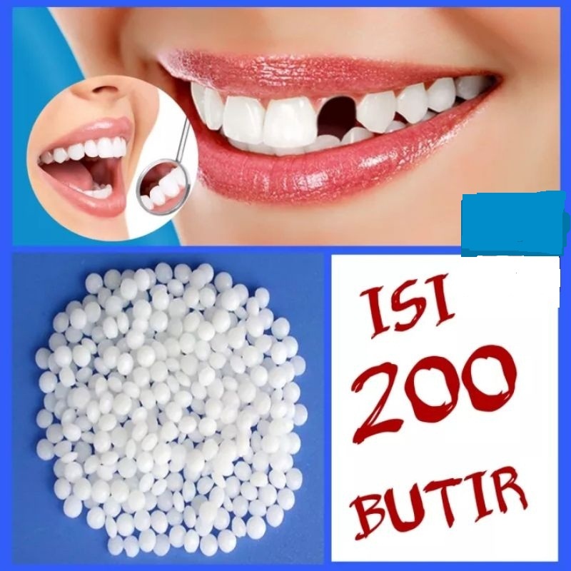 GIGI PALSU SEMENTARA 200 BUTIR / PENAMBAL GIGI PATAH RENGGANG TEMPORARY TOOTH TEMPTOOTH GINGSUL PATA