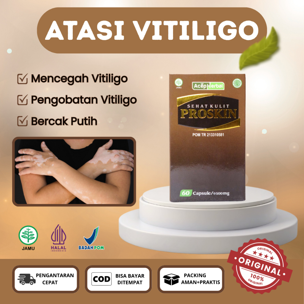 Obat Untuk Vitiligo Pada Kulit, Pengobatan Vitiligo, Penyebaran Bercak Putih-Kapsul Proskin