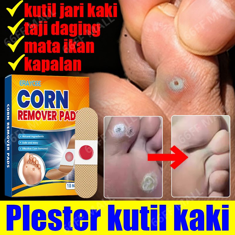 plester mata ikan obat mata ikan plester kutil salep mata ikan telapak kaki obat untuk mata ikan cor