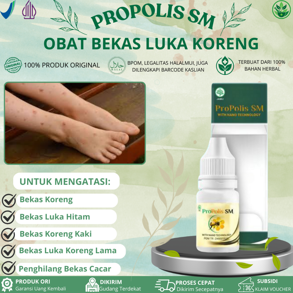Propolis SM Untuk Penghilang Bekas Luka Koreng, Bekas Luka Hitam, Koreng Di Kaki, Bekas Luka Koreng 