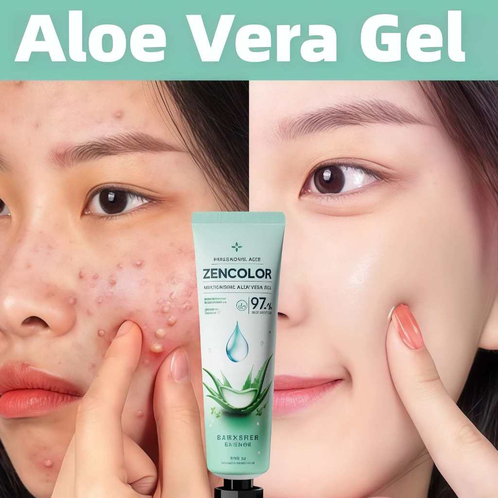 30g Aloe Vera Gel Repair Skin Bekas Jerawat Pelembab Gel Lidah Buaya Lidah Buaya Gel Untuk Wajah Moi