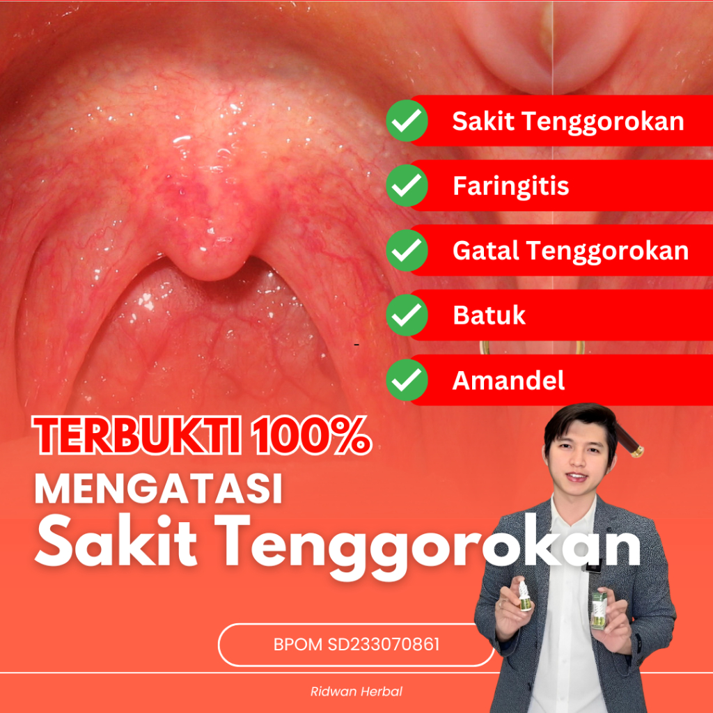Obat Sakit Tenggorokan, Obat Nyeri Tenggorokan, Obat Tenggorokan Gatal, Obat Tenggorokan Bengkak, Ob