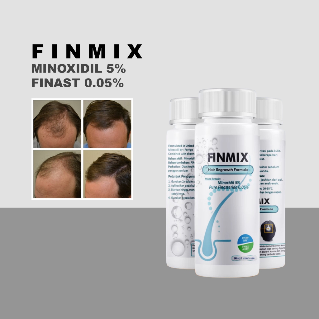 FINMIX - Minoxidil 5% & Finas Untuk Penumbuh Rambut Pria