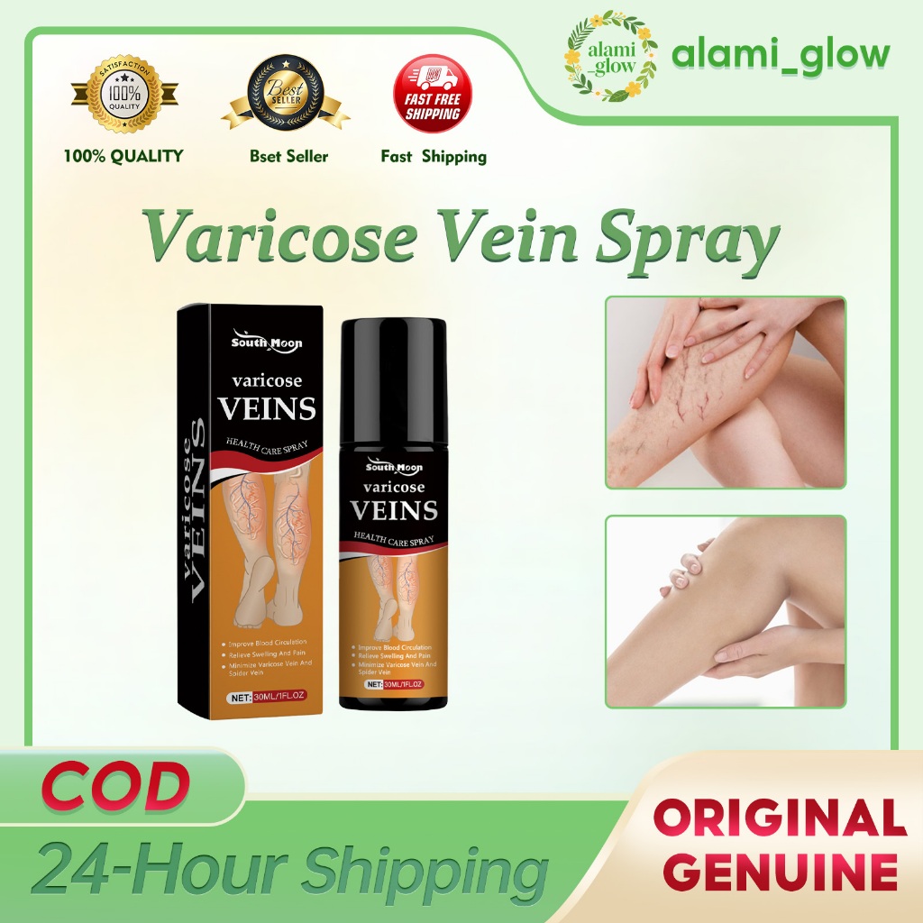 South Moon Varicose Vein Spray 30ml obat varises spray Dengan Semprotan Vasculitis Phlebitis semprot