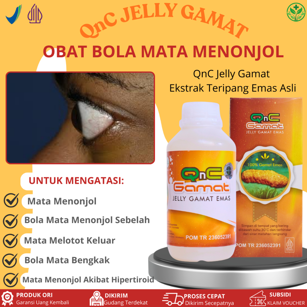 QnC Jelly Gamat Untuk Mata Menonjol, Bola Mata Menonjol Sebelah, Mata Bengkak Menonjol, Mata Melotot