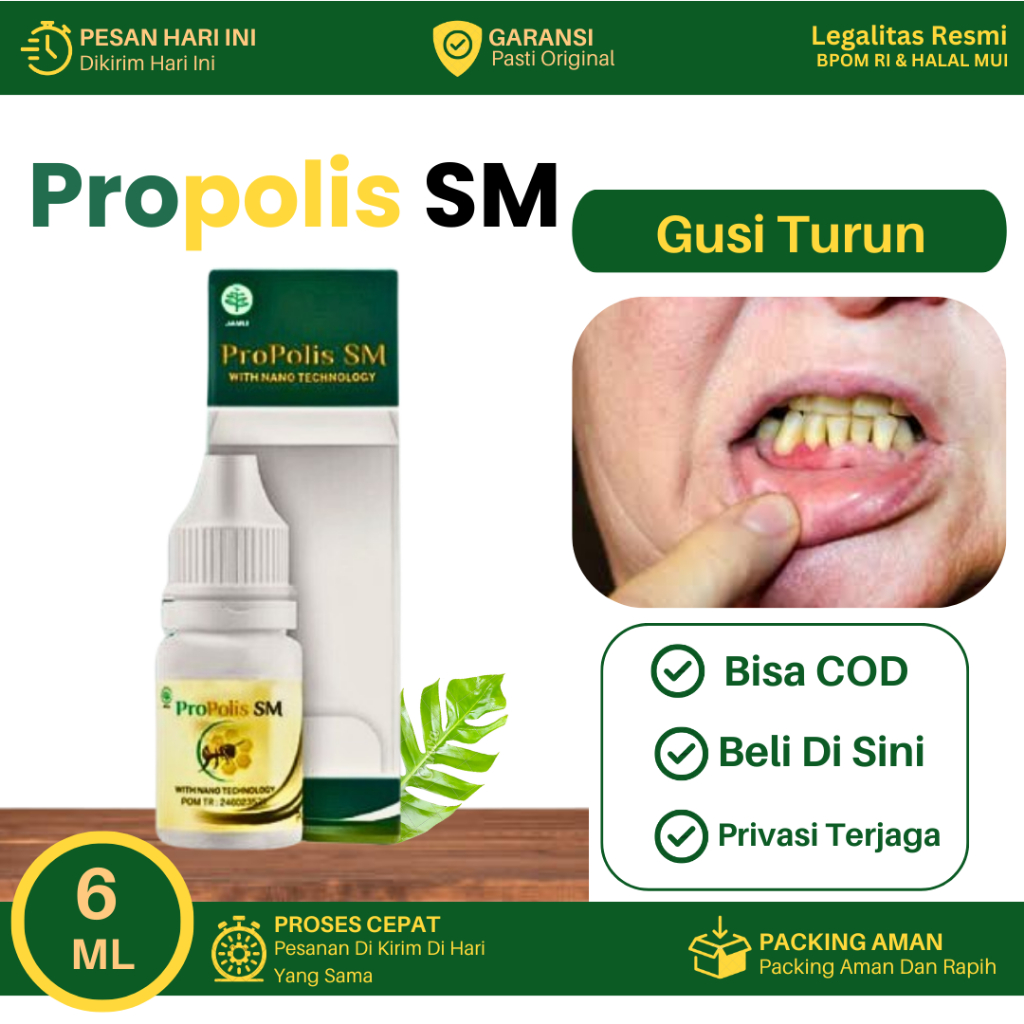 Obat Gusi Turun, Resesi Gusi, Gusi Turun Karena Behel Gigi, Sakit Gusi Turun Atasi Dengan Propolis S