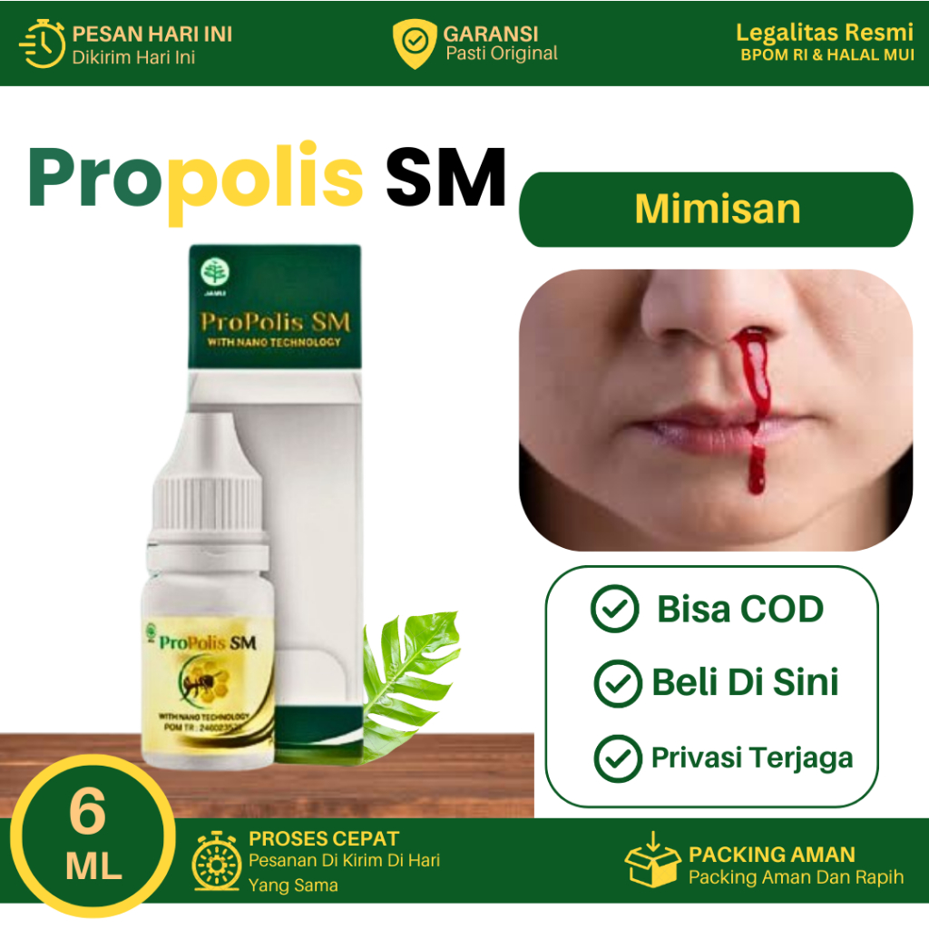 Obat Untuk Mimisan, Mimisan Menahun, Mimisan Berkepanjangan, Mimisan Disertai Sakit Kepala, Menghent