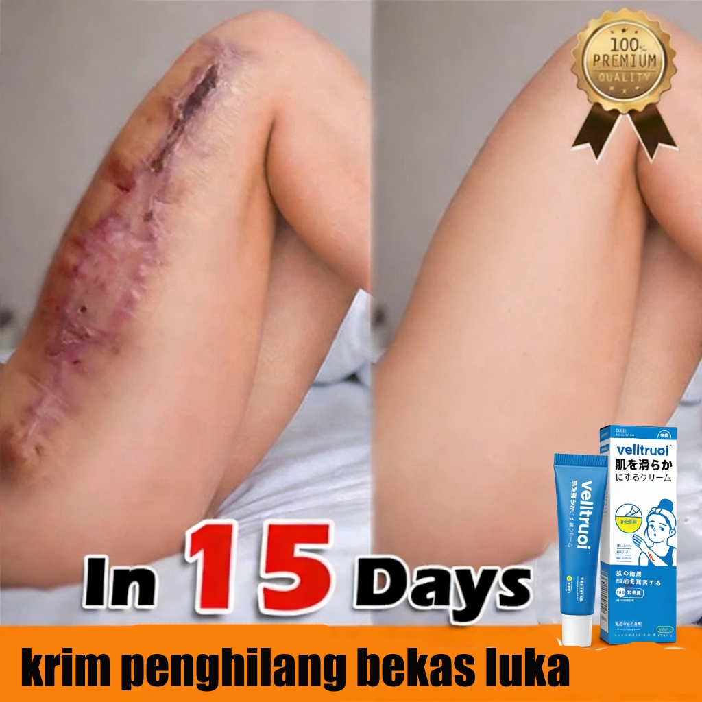 Salep Penghilang Bekas Luka Anak Menghilangkan Bekas Luka Menghitam Obat Keloid Di Kaki/Wajah Penghi