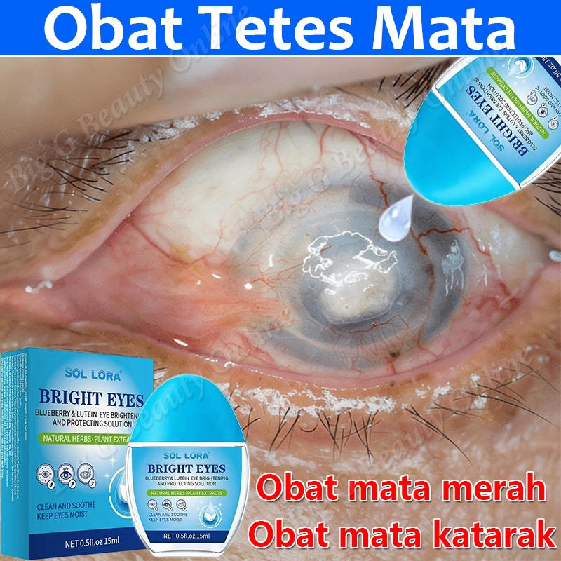 Obat Tetes Mata Katarak Obat Mata Merah Mata Kering Obat Mata Buram Obat Sakit Mata Obat Mata Berlem