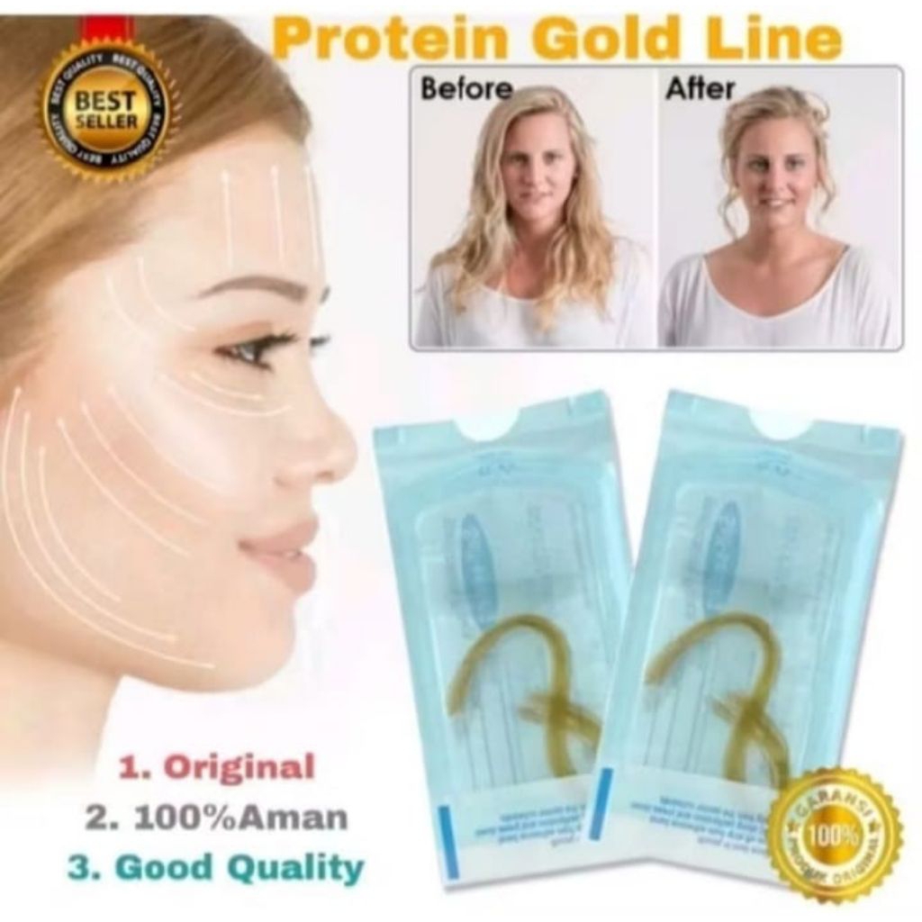 Protein Line/Tanam benang tanpa jarum