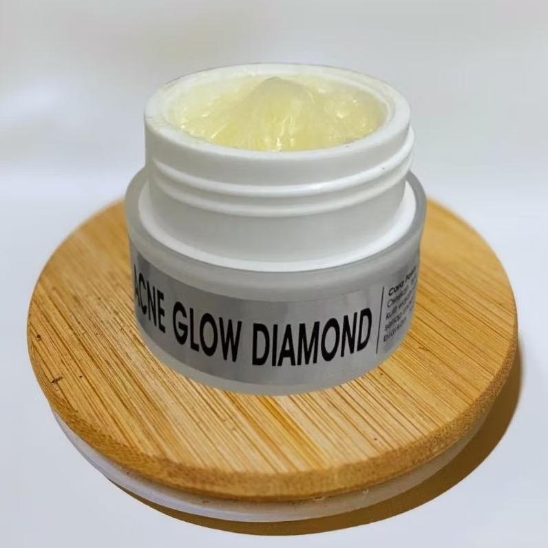 Cream Acne Glow Diamond/AGD/Acne Glowing Diamond Original