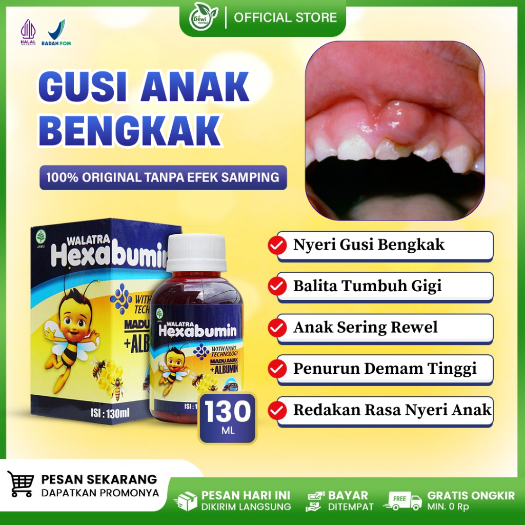 Obat Sakit Gusi Bengkak Pada Balita, Anak Sering Rewel, Badan Demam Tinggi, Gigi Tumbuh, Sakit Gigi 
