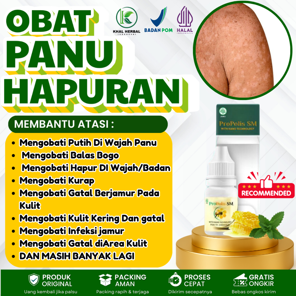 Obat Panu Di Kulit, Obat Panu di Wajah, Obat Bercak Putih Di Kulit, Obat Panu Di Pipi, Obat Hapuran,