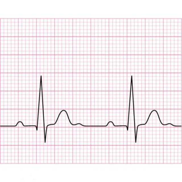 KERTAS monitor PHILIP 150mm X 100mm X 150sh Printer Alat Tes Laboratorium ECG EKG CTG