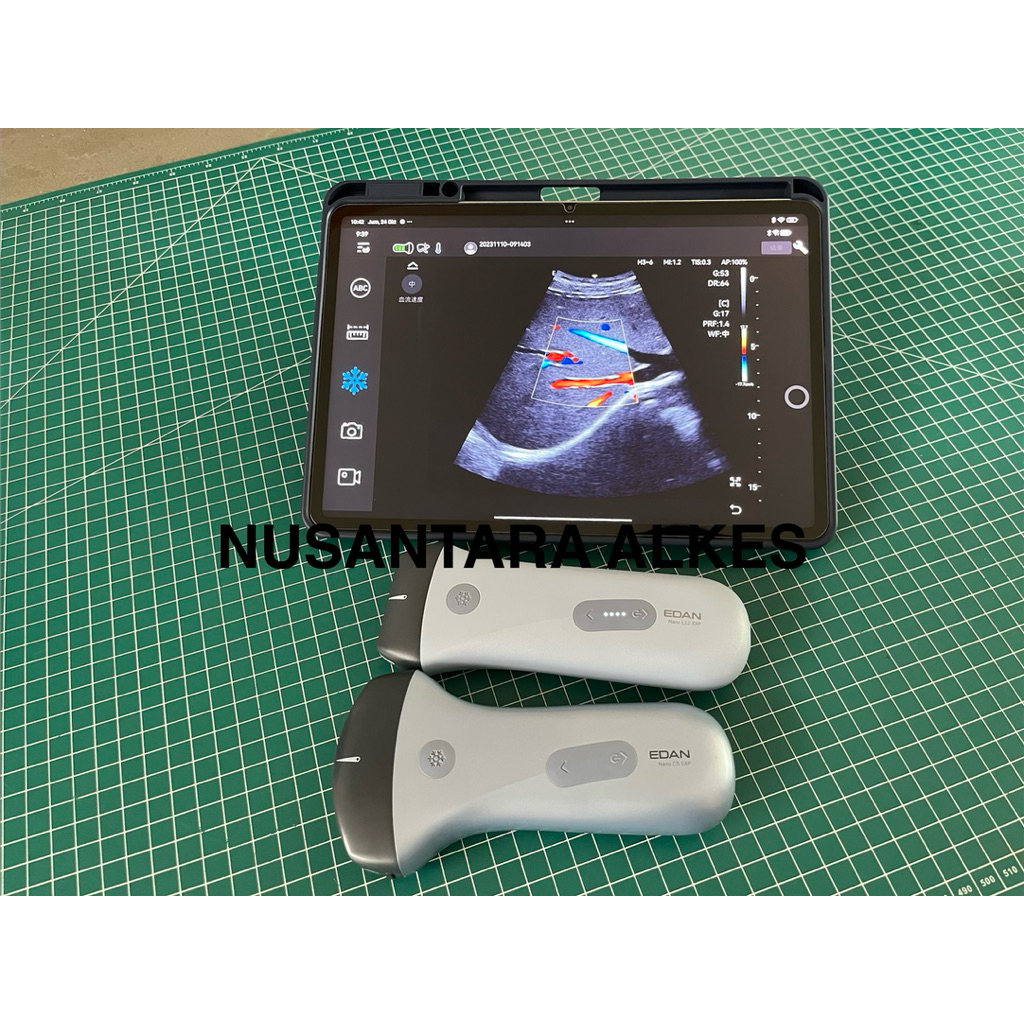 PROMO EDAN NANO USG WIRELESS / USG WIFI / USG POCKET / USG MINI / PROBE OBGYN / PROBE LINEAR MURAH D