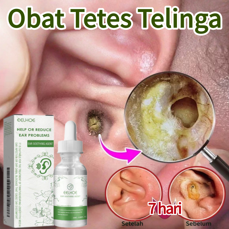 Tetes telinga pembersih kotoran Tetes telinga Pembersih kotoran telinga Tetes telinga berdengung Tet