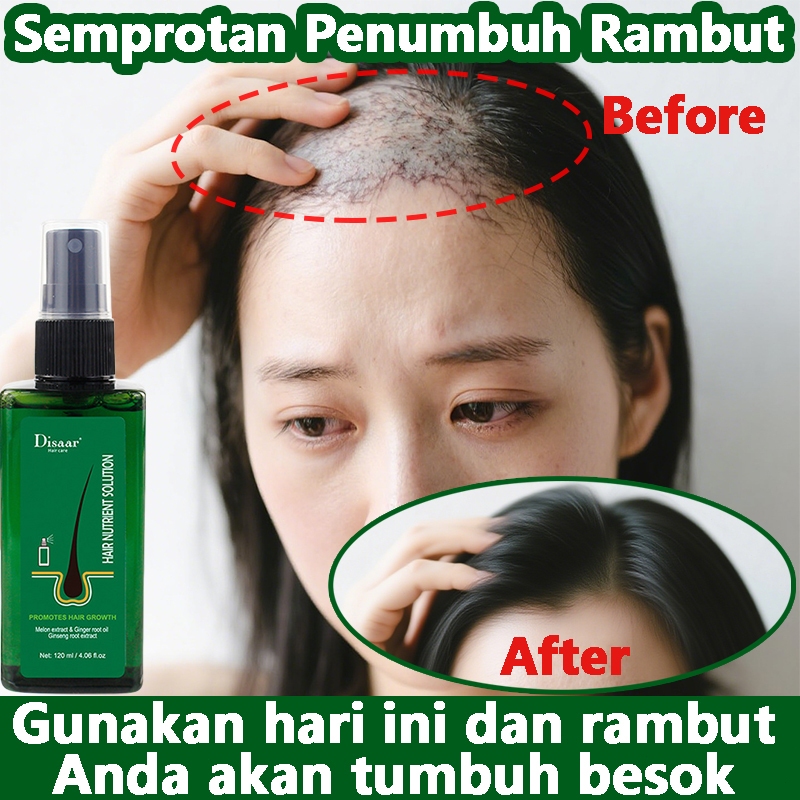 Penumbuh Rambut Anti Rontok 120ml ​Serum penumbuh rambut Semprotan anti rontok Obat penumbuh rambut 