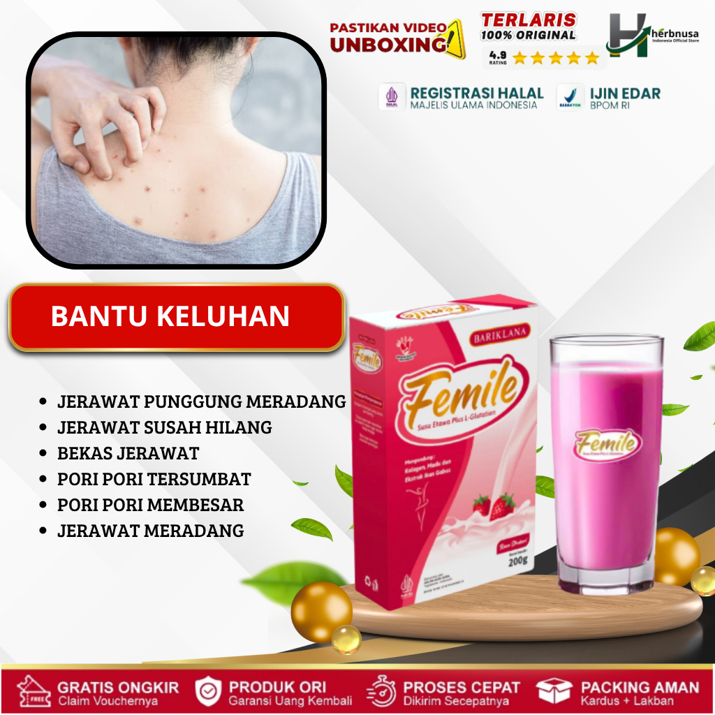 FEMILE ATASI JERAWAT PARAH, JERAWAT DI WAJAH DAN PUNDAK, JERAWAT BERNANAH, KULIT WAJAH KUSAM, TIDAK 