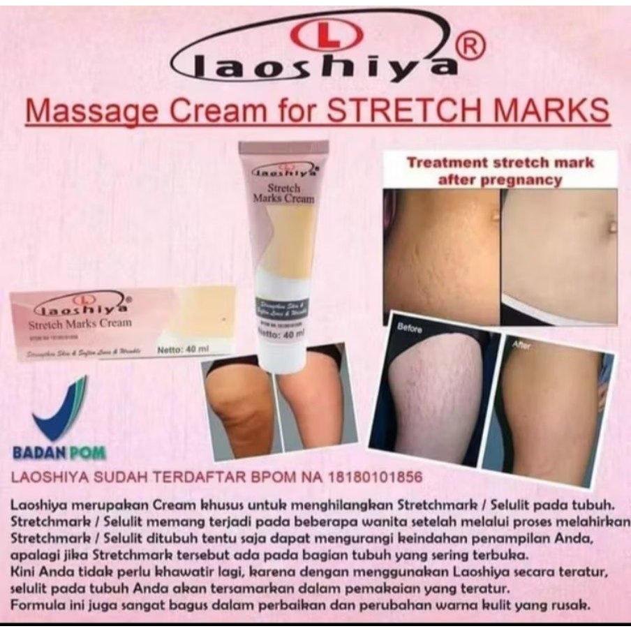 TB Krim Stretch Mark Herbal Penghilang stretch mark efektif menghilang stretch mark 120g penghilang 