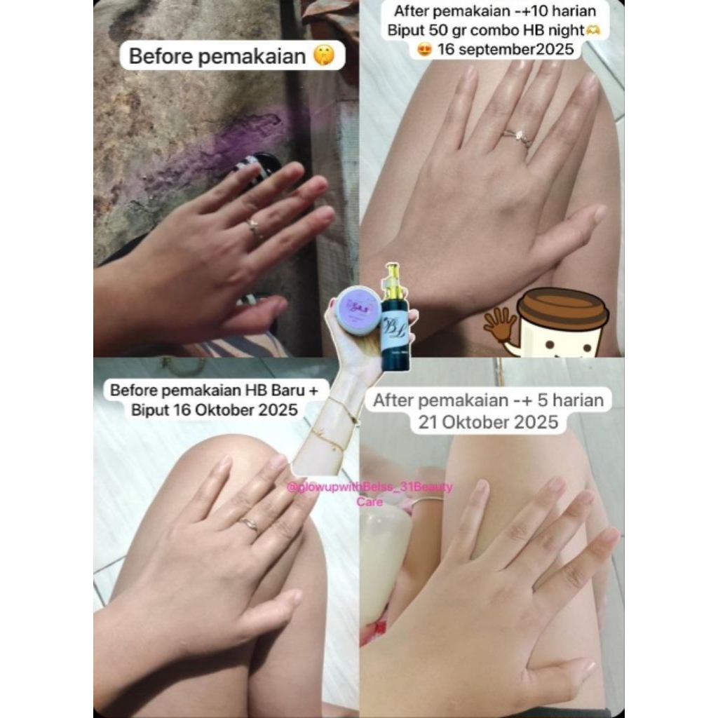 HB Super Whitening ampuh memutihkan kulit secara cepat