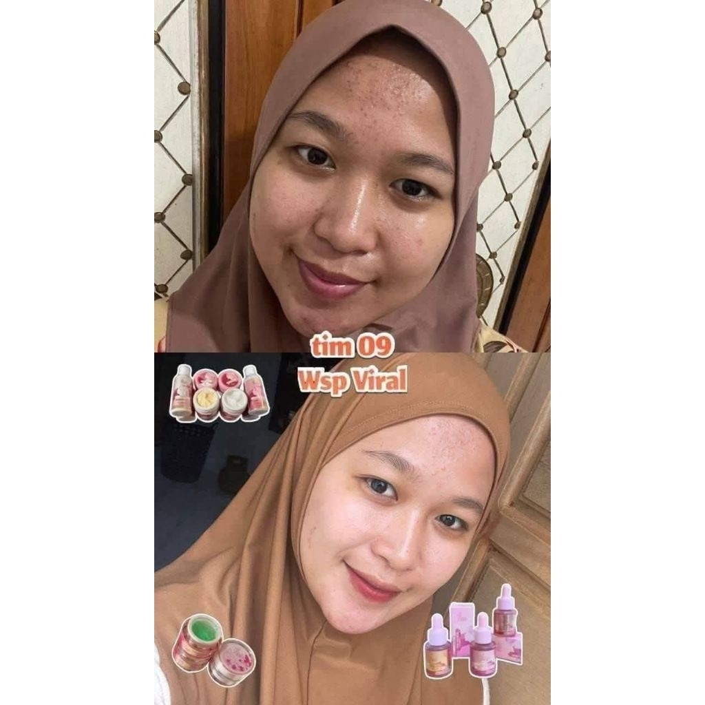 wsp skincare