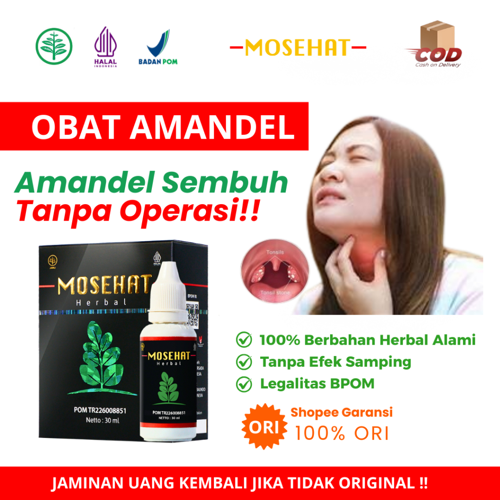 Mosehat OBAT AMANDEL Paling Ampuh Untuk Anak Dan Dewasa Tanpa Operasi