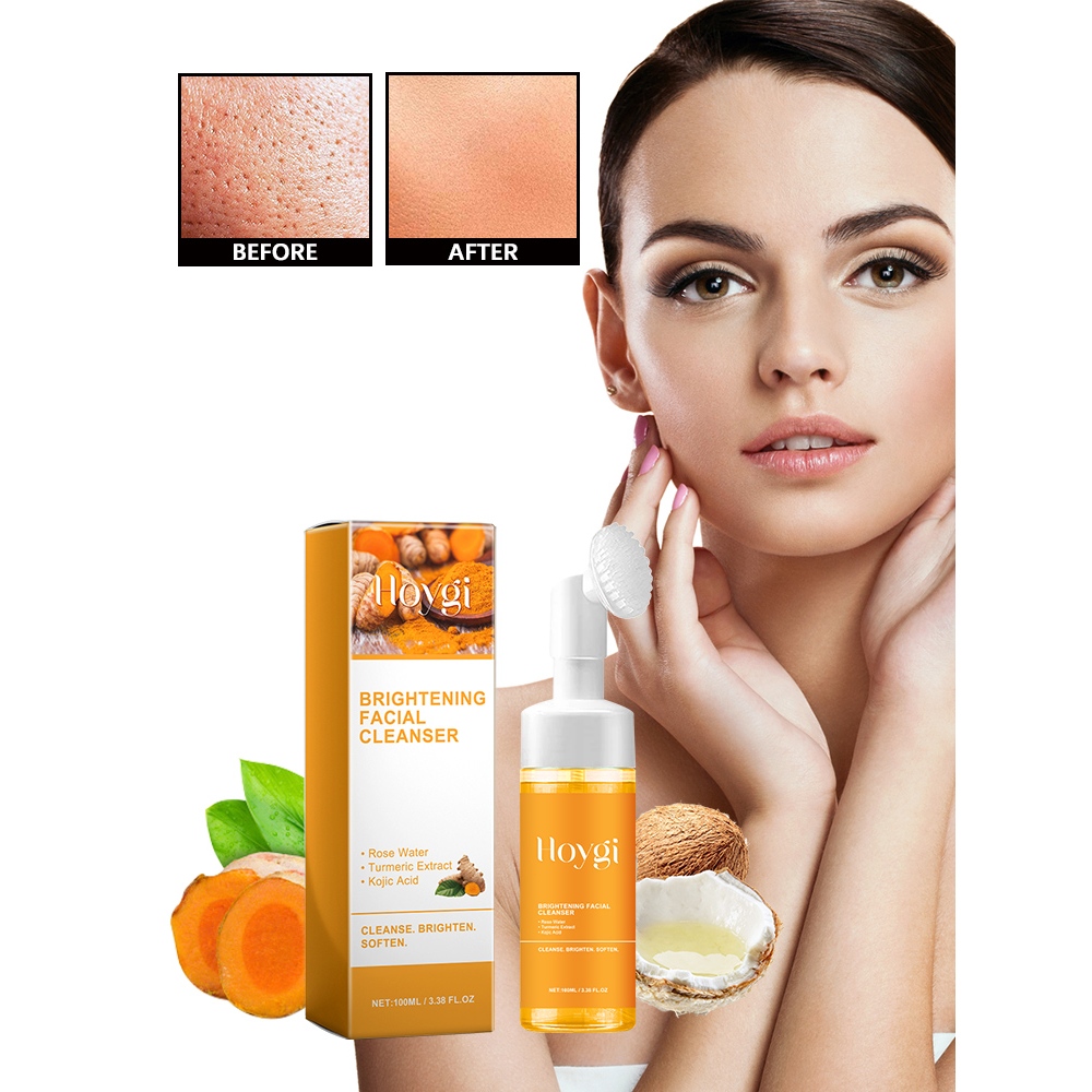 Hoygi Dark Spot Treatment Turmeric Face wash 100ml Dark Spot Treatment Turmeric Face wash Sabun Cuci