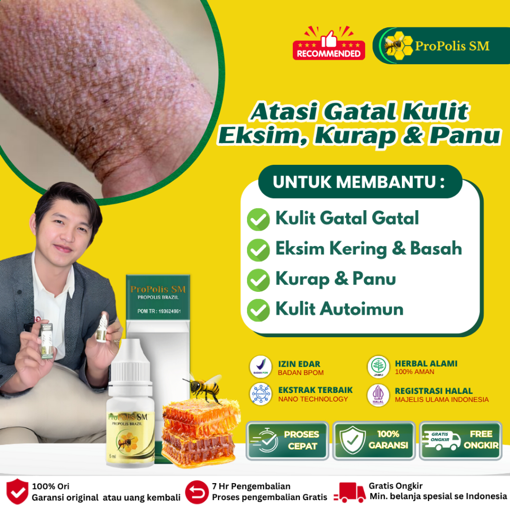 Obat Gatal Seluruh Badan Eksim - Obat Gatel Kulit Eksim - Obat Jamur Kulit - Kulit Gatal Dan Kering 