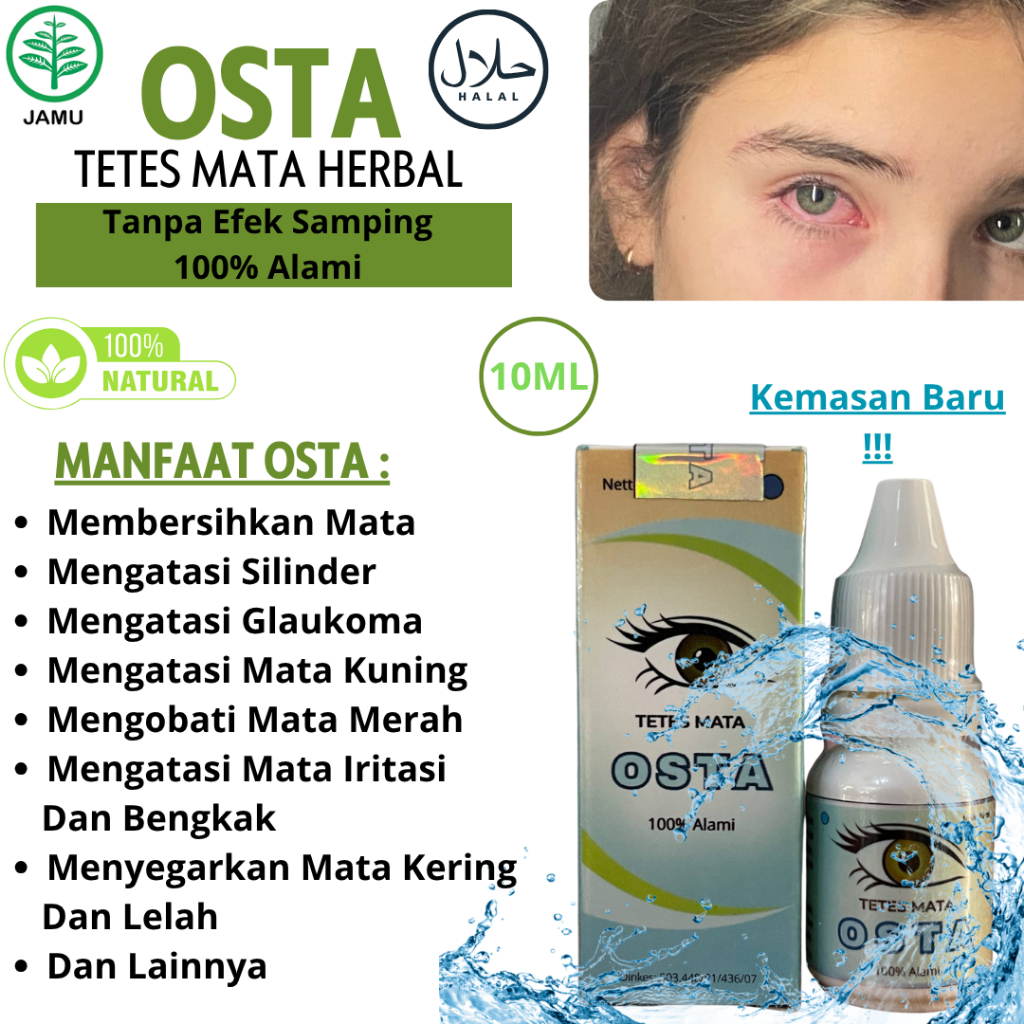 Osta Tetes Mata Herbal Obat Mata Merah Iritasi dan Berlemak
