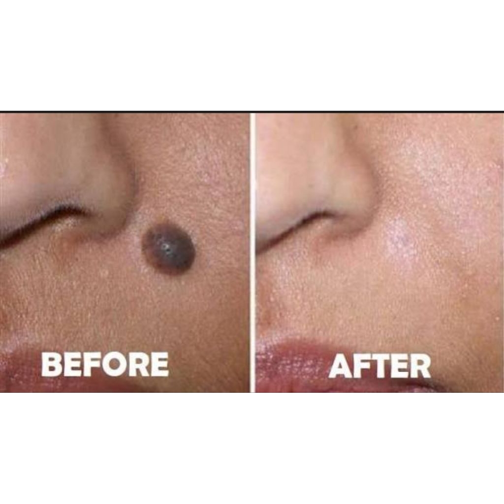 PENGHILANG TAHI LALAT HIDUP (RACIKAN BANJAR)