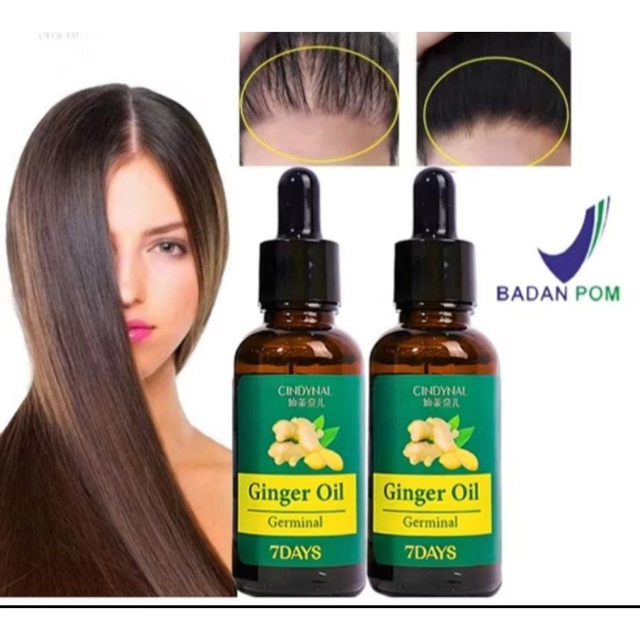Cindynal Ginger Hair Growth oil 7 days