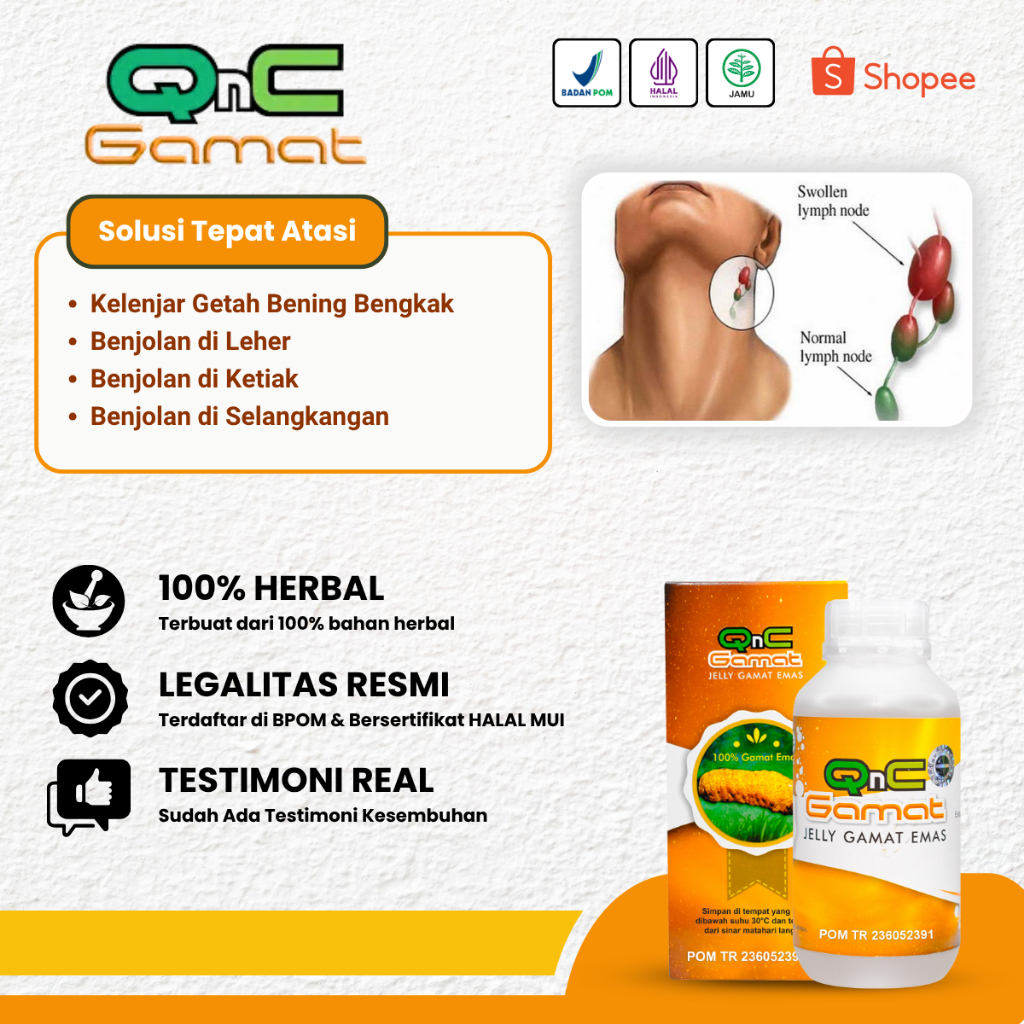 Obat Kelenjar Getah Bening Benjolan di Leher Ketiak Selangkkangan, Pembengkakan Kelenjar Getah Benin