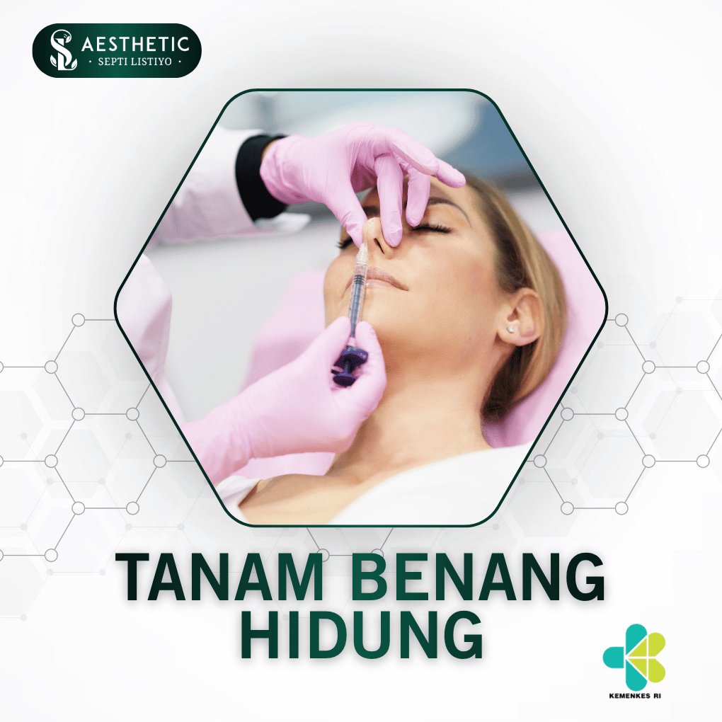 E - Vocer Tanam Benang Hidung Aman & Natural | Nose Thread Lift oleh Dokter Estetika | Hasil Mancung