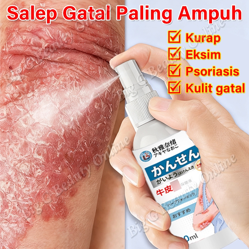 Obat Gatal Kulit Semprotan Obat Kurap Psoriasis Spray Gatal Selangkangan Dan Kelamin Obat Eksim Dan 