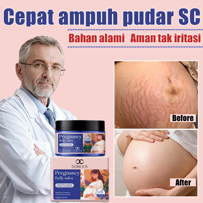 penghilang strechmark  stretch mark cream  cream penghilang  stretch mark  Krim Stretch Mark - Mengh