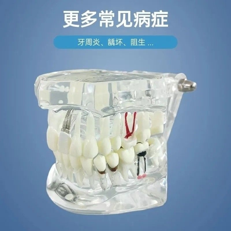 model gigi model study gigi edukasi studi implant model gigi dental study model phantom gigi bisa di