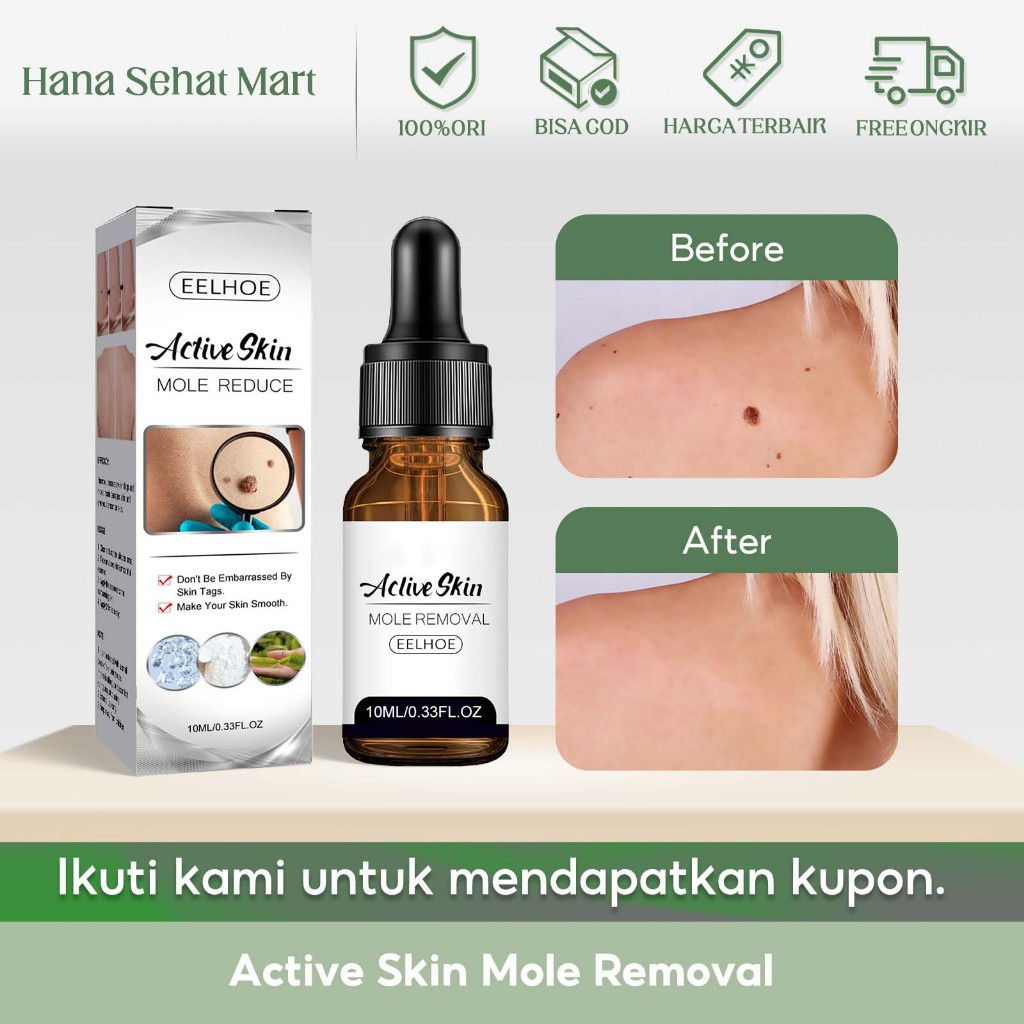 EELHOE Active Skin Mole Removal 10ml Serum Penghilang Kutil Kulit Efektif Menghilangkan Kutil Dan Ta