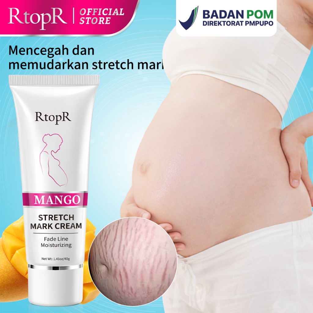 BPOM RtopR Mango Stretch Mark Cream Penghapusan Tanda Peregangan Skincare Penghilang Pemudar Stretch