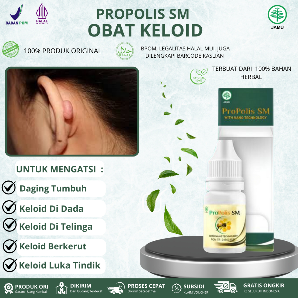 Obat Keloid, Daging  Tumbuh, Daging Jadi,Keloid Di Dada, Keloid Di Telinga, Keloid Luka tindik